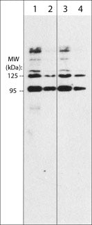 Western blots of human recombinant Sema3A/Fc chimera (95/125 kDa) (lanes 1-4). The blots were probed with rabbit polyclonal Sema3A (Central region) at 1:250 (lane 1) and 1:1000 (lane 2) and mouse monoclonal Sema3A (Central region) at 1:250 (lane 3) and 1:1000 (lane 4). Both antibodies recognize the 95 kDa and 125 kDa forms of the recombinant Sema3A.