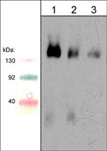 Western blot image of mouse brain lysate. The blot was probed with mouse monoclonal Semaphorin-4D antibody (SM1881) at 1:250 (lane 1), 1:500 (lane 2), and 1:1000 (lane 3).