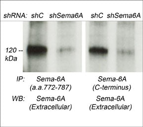Western blot of Sema-6A in human colorectal cancer (CRC) cells treated with control (shC) or Sema-6A (shSema6A) shRNAs. Sema-6A was immunoprecipitated from each of the CRC lysates using Sema-6A (a.a. 772-787) or Sema-6A (C-terminus) antibody, then the blotted immunoprecipitations were probed with Sema-6A antibody. (Images provided by Dr. Luca Tamagnone from the IRCC, Univ. of Torino, Italy).