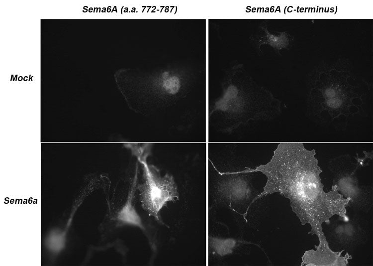 mmunocytochemical labeling of Sema-6A in COS7 cells that were mock transfected (top images) or Sema-6A transfected (bottom images). The cells were labeled with anti-Sema-6A (a.a. 772-787) (Left top and bottom image) or anti-Sema-6A (C-terminus) (Right top and bottom image). The antibodies were detected using anti-rabbit fluorescent secondary antibody. (Images provided by Dr. Luca Tamagnone from the IRCC, University of Torino, Italy).