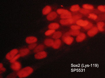 Immunocytochemical labeling of methylated Sox2 in aldehyde fixed and NP-40 permeabilized human NCI-H446 lung carcinoma cells. The cells were labeled with rabbit polyclonal anti-Sox2 (Lys-119)
methyl-specific (SP5531). The antibody was detected using goat anti-rabbit DyLight® 594.