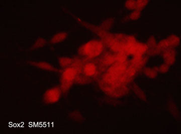 Immunocytochemical labeling of Sox2 in aldehyde fixed and NP-40 permeabilized human NCI-H446 lung carcinoma cells. The cells were labeled with mouse monoclonal anti-Sox2 (SM5511). The antibody was detected using goat anti-mouse DyLight® 594.