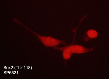 Immunocytochemical labeling of phosphorylated Sox2 in aldehyde fixed and NP-40 permeabilized human NCI-H446 lung carcinoma cells. The cells were labeled with rabbit polyclonal anti-Sox2 (Thr-118)
phospho-specific (SP5521). The antibody was detected using goat anti-rabbit DyLight® 594.
