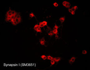 Immunocytochemical labeling of Synapsin I in rat PC12 cells differentiated with NGF. The cells were labeled with mouse monoclonal Synapsin I (C-terminal region) antibody, then detected using appropriate secondary antibody conjugated to Cy3.