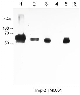 Immunocytochemical labeling of Trop-2 in paraformaldehyde fixed human A431 cells. The cells were labeled with mouse monoclonal anti-Trop-2 (clone M005). The antibody was detected using goat anti-mouse DyLight® 594.
