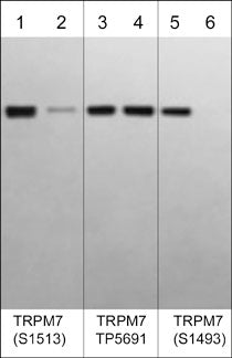 Western blot image of human autophosphorylated TRPM7 C-terminal kinase domain (lanes 1-6). The blot was treated with lambda phosphatase to dephosphorylate TRPM7 phosphosites (lanes 2, 4, & 6). The blot was probed with rabbit polyclonals anti-TRPM7 (Ser-1513), phospho-specific (lanes 1 & 2),  anti-TRPM7 (a.a.1484-1497), TP5691 antibody (lanes 3 & 4), or anti-TRPM7 (Ser-1493), phospho-specific (lanes 5 & 6).