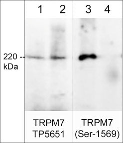 Western blot image of rat PC12 cells (lanes 1-4). The blot was treated with lambda phosphatase to dephosphorylate TRPM7 (lanes 2 & 4). The blot was probed with rabbit polyclonals anti-TRPM7 (Extracellular region) TP5651 (lanes 1 & 2) or anti-TRPM7 (Ser-1569), phospho-specific (lanes 3 & 4).