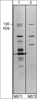Western blot image of human TRPM8 in human MDA-MB-231 cells. The blot was probed with mouse monoclonal anti-TRPM8 (extracellular region) clone M571 (lane 1) or clone M572 (lane 2).