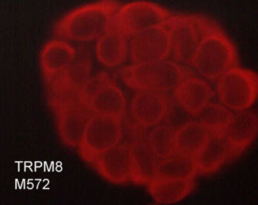 Immunocytochemical labeling of TRPM8 in paraformaldehyde fixed and NP-40 permeabilized MCF-7 cells. The cells were labeled with mouse monoclonal anti-TRPM8 (M572). The antibody was detected using goat anti-mouse DyLight® 594.