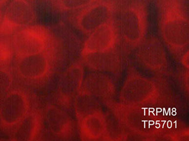 Immunocytochemical labeling of TRPM8 in paraformaldehyde fixed and NP-40 permeabilized MCF-7 cells. The cells were labeled with rabbit polyclonal anti-TRPM8 (TP5701). The antibody was detected using goat anti-rabbit DyLight® 594.