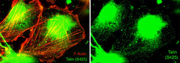 Immunocytochemical labeling of Talin phosphorylation relative to F-actin in chick fibroblasts. The cells were labeled with rabbit polyclonal Talin (Ser-425) antibody (TP4171), then the antibody was detected using appropriate secondary antibody (Green). This labeling is compared to F-actin staining (Red, Left). (Image provided by Dr. Gianluca Gallo at Drexel University).