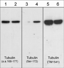Western blot analysis of purified brain tubulin untreated (lanes 1,3,5) or treated with ERK2 kinase to phosphorylate Ser-172 (lanes 2,4,6). The blot was probed with anti-β-Tubulin (a.a. 168-177) (lanes 1 & 2), anti-β-Tubulin (Ser-172) (lanes 3 & 4), and anti-β-Tubulin (TM1541) (lanes 5 & 6).