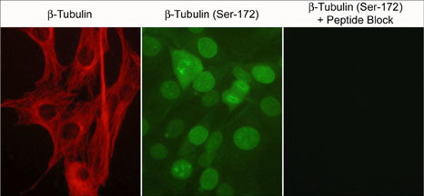 Immunocytochemical labeling in C2C12 cells using anti-β-Tubulin (TM1541) monoclonal antibody and anti-β-Tubulin (Ser-172) polyclonal antibody. The specificity of the binding for the latter antibody was demonstrated by using the antibody in the presence of phospho-β-Tubulin (Ser-172) peptide (TX1725).