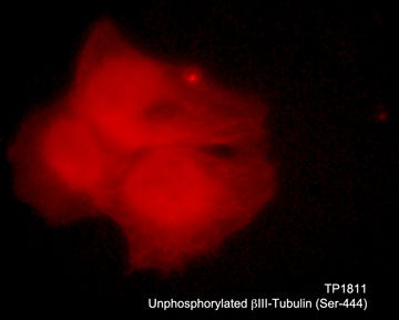 Immunocytochemical labeling of β-tubulin in aldehyde fixed and NP-40 permeabilized human NCI-H1299 lung carcinoma cells. The cells were labeled with rabbit polyclonal anti-unphosphorylated β-Tubulin (TP1811). The antibody was detected using goat anti-rabbit DyLight® 594.