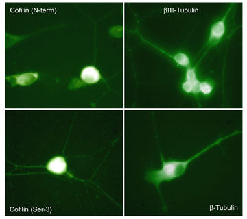 Immunocytochemical labeling in chick dorsal root ganglion neurons using anti-Cofilin (N-terminus; CP1131), anti-Cofilin (Ser-3; CP1151), anti-βIII-Tubulin (C-terminus; TP1691) and anti-β-Tubulin (TM1541) antibodies. (Images provided by Dr. Diane Snow, Department of Anatomy & Neurobiology, University of Kentucky).