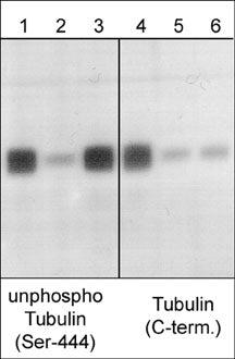 Western blot analysis of mouse brain. The blot was probed with anti-unphosphorylated βIII-Tubulin (Ser-444) (lanes 1-3) and anti-βIII-Tubulin (C-terminus) (lanes 4-6) polyclonal antibodies. Both antibodies were used in the presence of unphosphorylated βIII-Tublin (Ser-444) peptide (lanes 2 & 5; TX1815) and phospho-βIII-Tublin (Ser-444) peptide (lanes 3 & 6; TX1695).