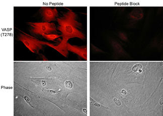 Immunocytochemical labeling of VASP phosphorylation in rabbit spleen fibroblasts treated with Calyculin A. The cells were labeled with rabbit polyclonal VASP (Thr-278) antibody, then detected using appropriate secondary antibodies conjugated to Cy3. The antibody was used in the absence (top left) or presence (top right) of blocking peptide (VX2785). Corresponding phase images are shown bottom left and right.