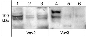 Western blot of human Jurkat (lanes 1 & 4), HUVEC (lanes 2 & 5), and A431 (lanes 3 & 6) cells. The blots were probed with anti-Vav2 (a.a. 309-322) at a dilution of 1:500 (lanes 1-3) and anti-Vav3 (a.a. 293-305) at 1:500 (lanes 4-6).