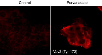Immunocytochemical labeling of VAV2 in control and pervanadate-treated human A431 cells. The cells were fixed in paraformaldehyde and permeabilized using NP-40. Then labeled with rabbit polyclonal Vav2 (Tyr-172). The antibody was detected using goat anti-rabbit DyLight® 594.