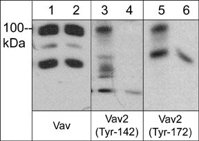 Western blot of human A431 cells treated with EGF (lanes 1, 3, & 5) then the blot was exposed to alkaline phosphatase (lanes 2, 4, & 6). The blots were probed with anti-Vav (a.a. 165-174) (lanes 1 & 2), anti-Vav2 (Tyr-142) (lanes 3 & 4), or anti-Vav2 (Tyr-172) (lanes 5 & 6).