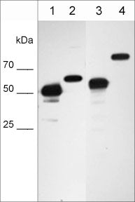 Western blot image of cell structure markers in NCI-H1915 lung carcinoma cells. The blot was probed with anti-Vimentin intermediate
filament protein VM4341 (lane 1), anti-Nucleoporin p62 NM4361 (lane 2), anti-Hsp60 mitochondrial protein HM4381 (lane 3), and anti-Calnexin endoplasmic reticulum protein CM4371 (lane 4).