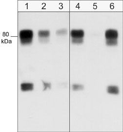 Western blot of human SYF cSrc-transformed cells. Blots were were probed with anti-WAVE1 (N-terminal region) at a dilution of 1:1000 (lane 1), 1:2000 (lane 2) or 1:4000 (lane 3). In addition, the antibody was used in the absence (lane 4) or presence of blocking peptides, WAVE1 (N-terminal region) peptide (lane 5) or WAVE2 (Central region) peptide (lane 6).