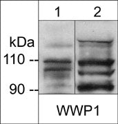 Western blot analysis of WWP1 expression in adult mouse liver (lane 1) and human prostate adenocarcinoma (PC3) cells (lane 2). The blot was probed with anti-WWP1 (WP3931) at 1:1000.