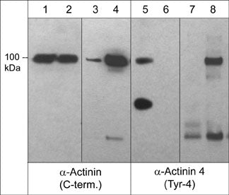 Western blot analysis of α-actinin 4 in A431 cells stimulated with pervanadate (1 mM) for 30 min (lanes 1,2,5.6) or after immunoprecipitation using α-actinin (C-terminal region) antibody in the absence (lanes 3 & 7) or presence of pervanadate-treated A431 cell lysate (lanes 4 & 8). Some lanes of the blot were treated with alkaline phosphatase (lanes 2 & 6). The blots were probed with anti-α-actinin (C-terminal region) or anti-α-actinin 4 (Tyr-4).