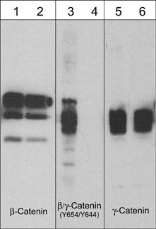 Western blot analysis of A431 cells stimulated with pervanadate (1 mM) for 30 min (lanes 1, 3, & 5) then treated with akaline phosphatase (lanes 2, 4, & 6). The blot was probed with anti-β-Catenin (CM1181) (lanes 1 & 2), anti-β-Catenin (Tyr-654) (CP4021) (lanes 3 & 4), or anti-γ-Catenin (CM1111) (lanes 5 & 6).
