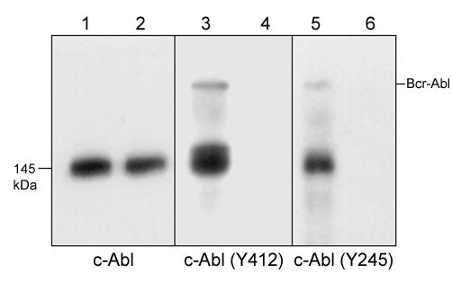Western blot analysis of K-562 cells treated with pervanadate (1 mM) for 30 minutes (lanes 1, 3, & 5). Some lanes were treated with alkaline phosphatase to remove phosphorylation on c-Abl (lanes 2, 4, & 6), then the blots were probed with anti-c-Abl (lanes 1 & 2), anti-c-Abl (Tyr-412) (AP1271; lanes 3 & 4), or anti-c-Abl (Tyr-245) (AP1251; lanes 5 & 6).
