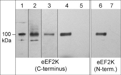 Western blot image of eEF2K in human A431 (lane 1), Jurkat (lane 2), and HeLa (lane 3) cells, and immunoprecipitation of eEF2K from HeLa cell lysate using anti-eEF2K (C-terminus) antibody (lanes 4 & 6). Negative control immunopreciptations with no antibody are shown in lane 5 and 7. The blots were probed with anit-eEF2K (C-terminus) (lanes 1-5) or with anti-eEF2K (N-terminal) antibody (lanes 6 & 7).
