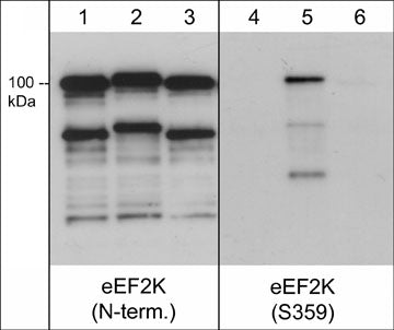 Recombinant human eEF2K untreated (lanes 1 and 4) and phosphorylated with p38 kinase in vitro (lanes 2 & 5). After in vitro reaction, the eEF2K was dephosphorylated with lambda phosphatase (lanes 3 & 6). The blots were probed with rabbit polyclonal anti-eEF2K (N-terminus) (lanes 1-3) or anti-eEF2K (Ser-359) (lanes 4-6). (Images provided by the laboratory of Dr. Kevin Dalby in the Dept. of Pharmacy at the University of Texas at Austin.)
