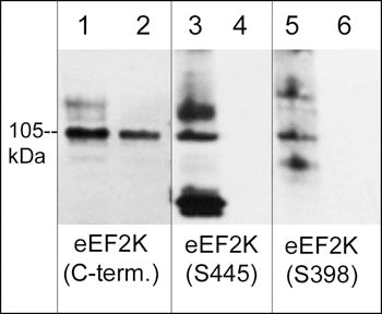 Western blot image of human Jurkat cells  treated with calyculin A (100 nM) for 30 min. (lanes 1-6), then some lanes of the blot were treated with lambda phosphatase (lanes 2, 4 & 6). The blot was probed with rabbit polyclonals anti-eEF2K (C-terminus) (lanes 1 & 2), anti-eEF2K (Ser-445) phospho-specific (lanes 3 & 4), and anti-eEF2K (Ser-398) phospho-specific (lanes 5 & 6).