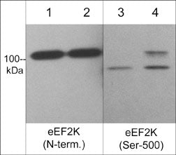 Western blot image of C2C12 untreated (lanes 1 & 3) or treated with calyculin A (100 nM) for 30 min. (lanes 2 & 4). The blot was probed with anti-eEF2K (N-terminus) (lanes 1 & 2) and anti-eEF2K (Ser-500) (lanes 3 & 4).