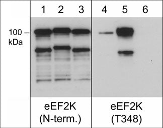 Recombinant human eEF2K untreated (lanes 1 & 4) and auto-phosphorylated in the presence of Ca2+ and Calmodulin (lanes 2 & 5). In some lanes, the eEF2K was dephosphorylated with lambda phosphatase (lanes 3 & 6). The blots were probed with rabbit polyclonal anti-eEF2K (N-terminus) (lanes 1-3) or anti-eEF2K (Thr-348) (lanes 4-6). (Images provided by the laboratory of Dr. Kevin Dalby in the Dept. of Pharmacy at the University of Texas at Austin.)