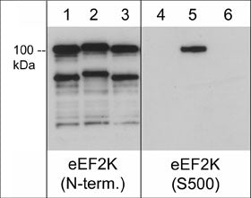 Recombinant human eEF2K untreated (lanes 1 & 4), auto-phosphorylated in the presence of Ca2+ and Calmodulin (lanes 2 & 5), and dephosphorylated with lambda phosphatase (lanes 3 & 6). The blots were probed with rabbit polyclonal anti-eEF2K (N-terminus) (lanes 1-3) or anti-eEF2K (Ser-500) (lanes 4-6). (Images provided by the laboratory of Dr. Kevin Dalby in the Dept. of Pharmacy at the University of Texas at Austin.)