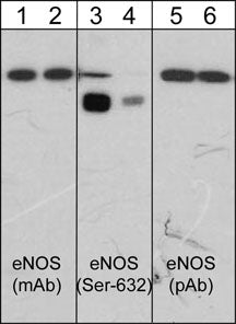 Western blot analysis of human umbilical vein endothelial cells stimulated with Calyculin A and untreated (lanes 1, 3, 5) or treated (lanes 2, 4, 6) with lambda phosphatase. The blots were probed with anti-endothelial Nitric Oxide Synthase (eNOS) monoclonal antibody (lanes 1 & 2), anti-eNOS (Ser-632) phospho-specific antibody (lanes 3 & 4), and anti-eNOS polyclonal antibody (lanes 5 & 6).