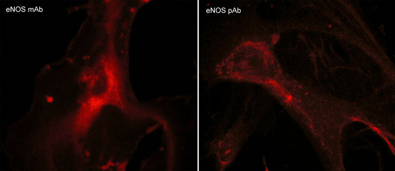 Immunocytochemical labeling of endothelial nitric oxide synthase (eNOS) in paraformaldehyde-fixed and NP-40-permeabilized human umbilical vein endothelial cells. The cells were labeled with mouse monoclonal eNOS (NM2211) and rabbit polyclonal eNOS (NP2281) antibodies, then the antibodies were detected using appropriate secondary antibodies conjugated to Cy3.