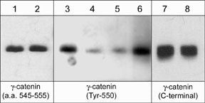 Western blot analysis of anti-γ-Catenin (C-terminal) immunoprecipitates from pervanadate-treated A431. The immunoprecipitates were untreated (lanes 1,3,7) or treated with alkaline phosphatase (lanes 2,4,8). The blots were probed with γ-Catenin (a.a. 545-555), γ-Catenin (Tyr-550) or γ-Catenin (C-terminal) antibodies. The anti-γ-Catenin (Tyr-550) was used in the presence of γ-Catenin (Tyr-550) (lane 5) or γ-Catenin (Tyr-644) (lane 6) peptides.