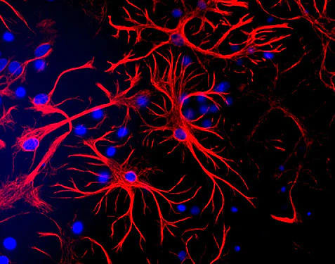 Glial Fibrillary Acidic Protein (GFAP) immunostaining (red) of mixed cortical mouse brain cultures (1:500 dilution). Secondary antibody is Texas Red goat anti-chicken IgY. The blue is DAPI staining of nuclei of all cells, including non-GFAP-positive cells. Photo courtesy of Dr. Gerry Shaw, Univ. Florida.