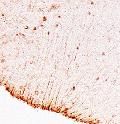 Immunohistochemical staining of GFAP-positive radial glial cells in the periventricular zone of an e16 mouse brain. Section was a vibratome, thick section (20 um) using a lightly-fixed (2% paraformaldehyde) mouse brain. 1˚ antibody (GFAP) was used at 1:500 dilution; 2˚ antibody (HRP-goat anti-chicken IgY) was used at 1:500 dilution.