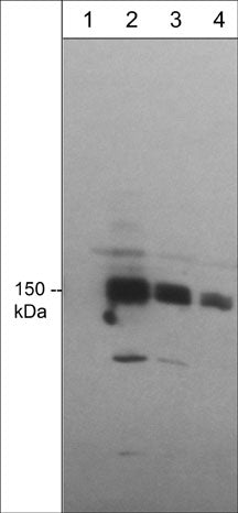 Western blot analysis of mDia1 expression in human Jurkat cells (lanes 1-4). The blots were probed with anti-mDia1 (a.a. 66-77: DP4471) in the presence (lane 1) or absence of blocking peptide (DX4475) using dilutions of 1:250 (lane 2), 1:1000 (lane 3), and 1:4000 (lane 4).
