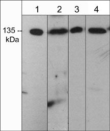 Western blot analysis of mDia2 expression in rat PC12 (lane 1), human A431 (lane 2), mouse brain (lane 3), and rabbit spleen fibroblasts (lane 4). The blots were probed with anti-mDia2 (C-terminal region) at 1:500.