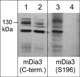 Western blot analysis of mDia3 expression in human Jurkat cells treated with Calyculin A (100 nM) (lanes 1-4). The blots were treated with lambda phosphatase (lanes 2 & 4), then probed with rabbit polyclonal anti-mDia3 (C-terminus; DP4511) (lanes 1 & 2) and anti-phospho-mDia3 (Ser-196; DP4521) (lanes 3 & 4).
