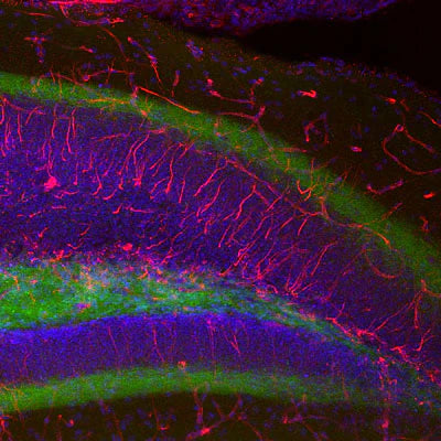 Photomicrograph of a paraffin-embedded tissue section through an adult dentate gyrus of the hippocampal formation from a paraformaldehyde-fixed (4%) mouse brain. Red shows nestin immunoreactivity (1:1000) as visualized with a Texas Red goat anti-chicken IgY antibody (Aves Labs, 1:500). Green is staining of the granule cells; blue is DAPI nuclear staining. Page Balich, Univ. Arizona.