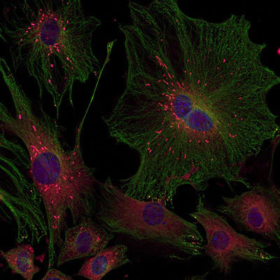 Photomicrograph of 3T3 cells in culture. Nestin immunoreactivity (red staining, 1:1000 dilution); green is β-Tubulin 3 staining using a rabbit antibody (1:500); blue is DAPI nuclear staining. Page Balich, Univ. Arizona.