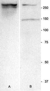 Nestin Western Blot. 20 ug of total protein from adult mouse brain in each lane. Lane A is Aves Labs' antibody (1:2000), showing a single, strong band at the correct molecular weight. Lane B uses a rabbit antibody from BD Transduction Labs showing a weak band at the same molecular weight, as well as another spurious band at about 145 kDa. Hoda Ilias, Aves Labs.
