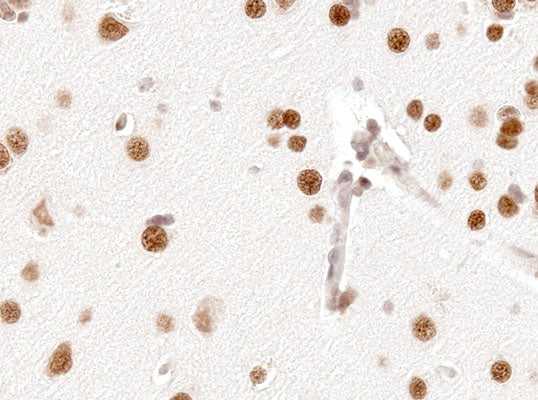 Immunohistochemical photomicrograph of neurons in cerebral cortex from a patient with Alzheimer's Disease. Parafin-embedded section. Anti-NeuN (1:1000 dilution); 2˚ antibody was H-1004 (HRP-labeled goat anti-chicken IgY, Aves Labs, 1:1000 dilution).
