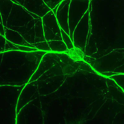 Cortical neuron from a neo-natal mouse brain culture immunocytochemically stained for NF-H immunoreactivity (1:5000 dilution). Secondary antibody (fluorescein-labeled goat anti-chicken IgY, (1:1000 dilution)