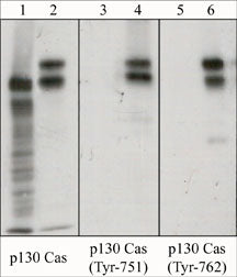 Western blot analysis of human endothelial cells serum starved overnight (lanes 1, 3, & 5) or treated with pervanadate (1 mM) for 30 minutes (lanes 2, 4, & 6). The blot was probed with anti-p130 Cas (PM1441; lanes 1 & 2), anti-p130 Cas (Tyr-751) (PP1581; lanes 3 & 4) or anti-p130 Cas (Tyr-762) (PP1451; lanes 5 & 6).